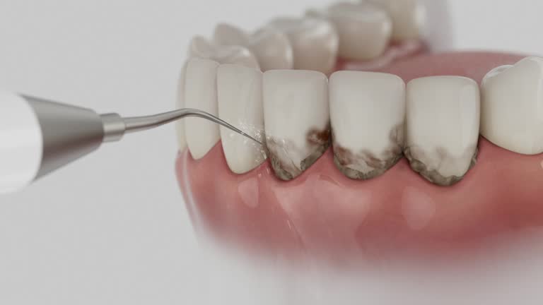 Trusted Teeth Cleaning And Checkup service in Burien, WA - Dentist Open Now